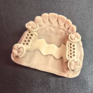 HPP Removable Dentures