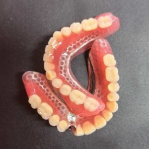 Metal Base Removable Dentures
