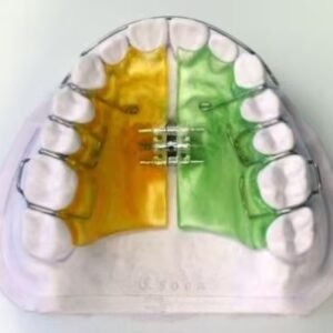 Advanced Orthodontics
