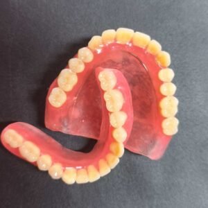 Conventional Complete Dentures