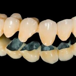 Co-Cr (Cobalt-Chromium) PFM Crowns
